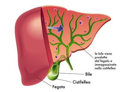 colica biliare